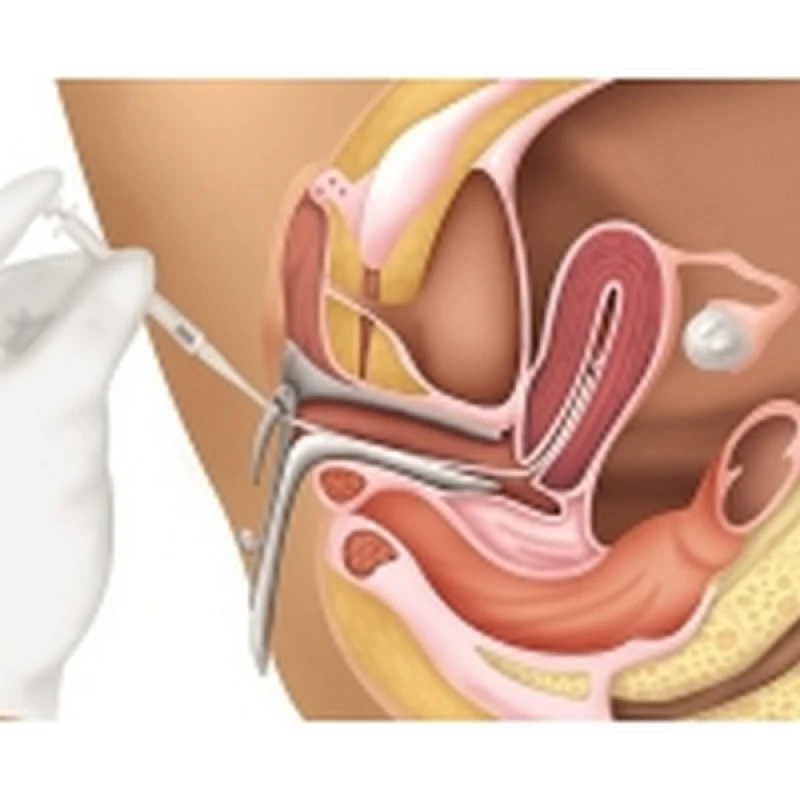 clínica de inseminação artificial