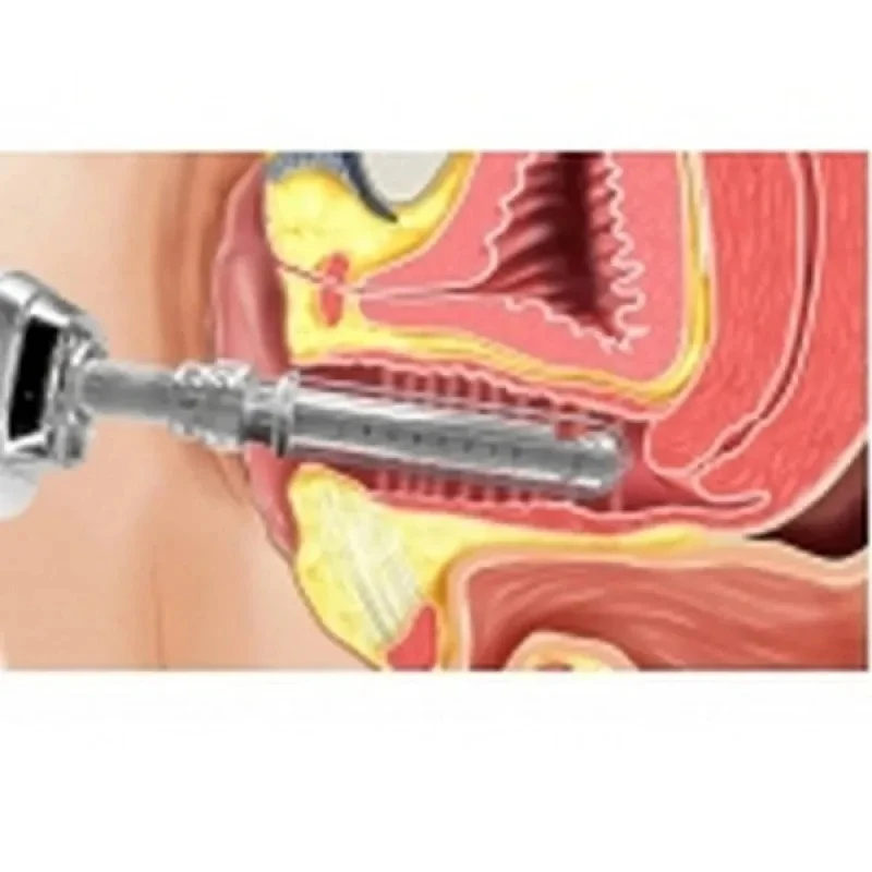 clínica de oncologia pélvica