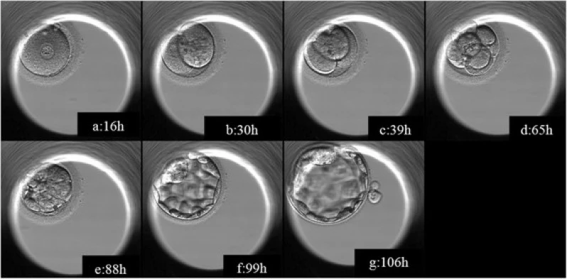 clínica fertilização para in vitro