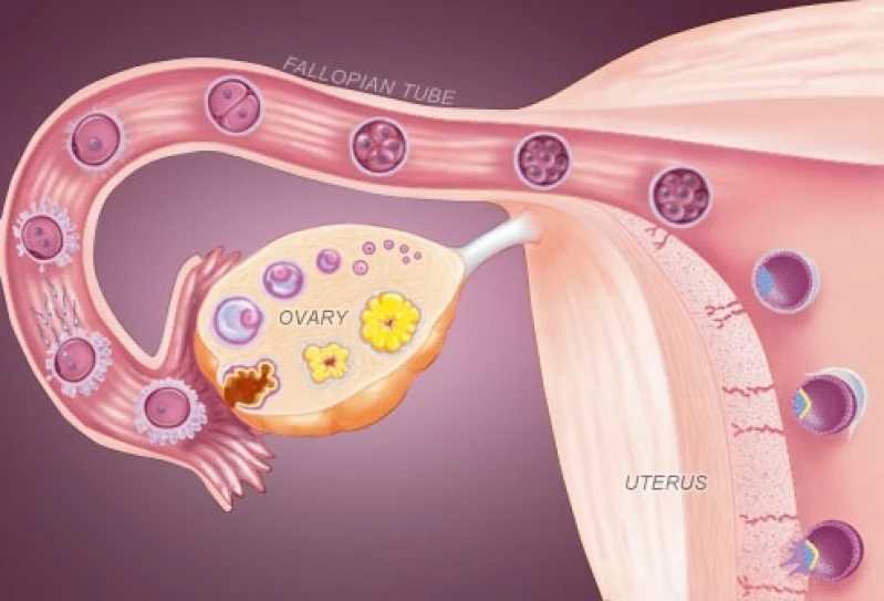 clínicas de fertilizações
