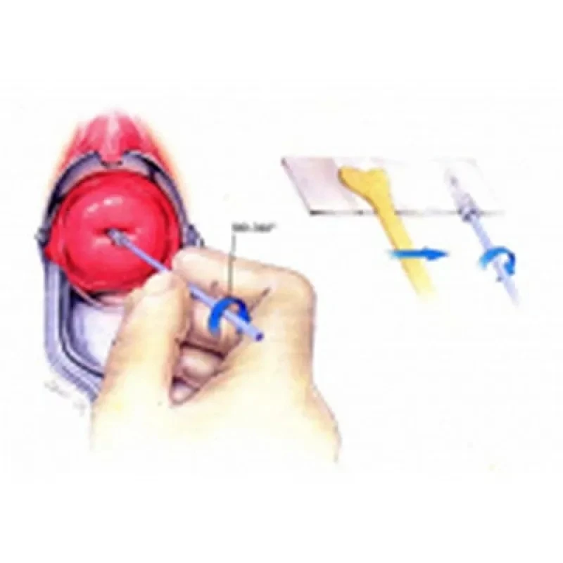 especialista em câncer pélvico