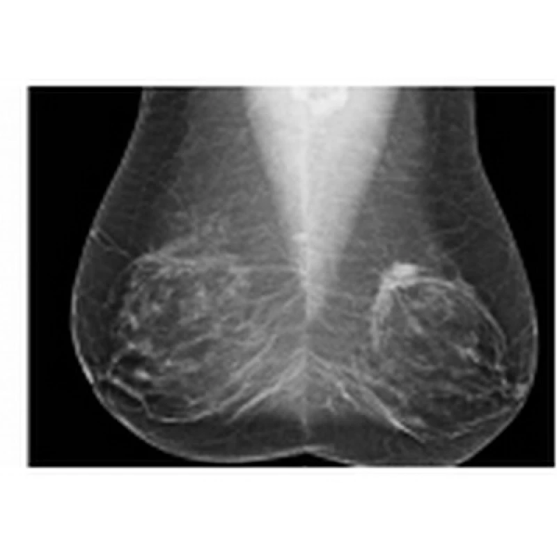 mastologista oncologista