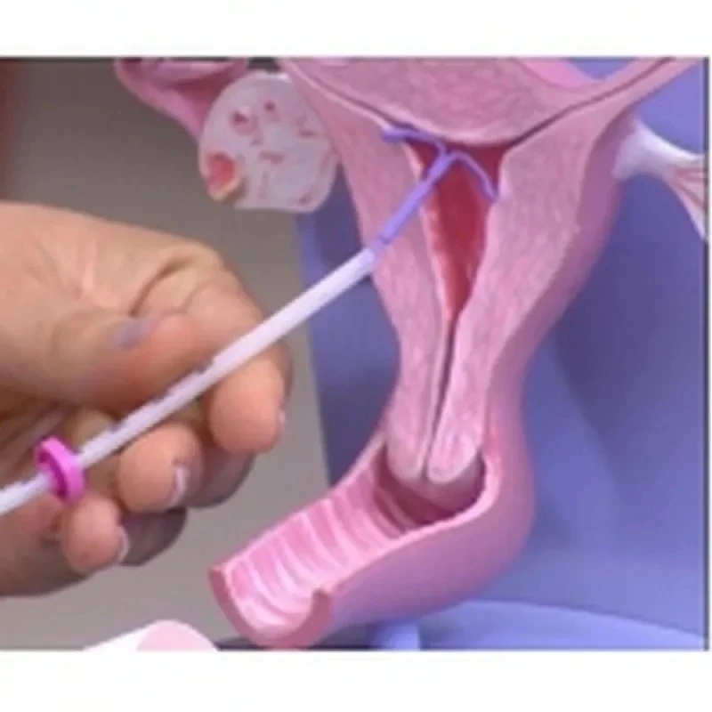 oncologista pélvico