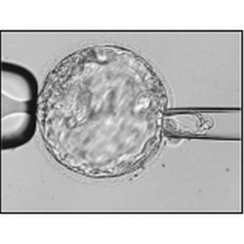 reprodução humana in vitro